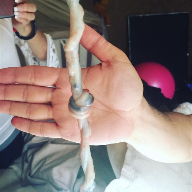 Vừa đón em bé chào đời, bác sĩ hét lên Bố đâu, nhanh đến chụp ảnh, con anh là một phép màu - Ảnh 2.