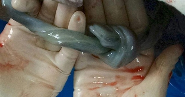 Vừa đón em bé chào đời, bác sĩ hét lên Bố đâu, nhanh đến chụp ảnh, con anh là một phép màu - Ảnh 3.