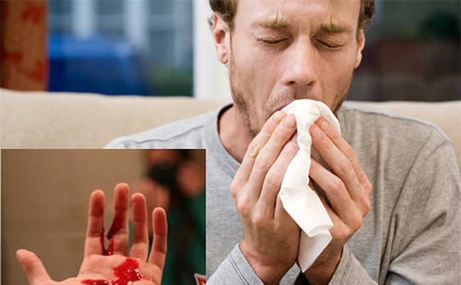 3 dấu hiệu của ung thư phổi: Chuyên gia nhắc dù chỉ 1 dấu hiệu nhỏ cũng không nên bỏ qua