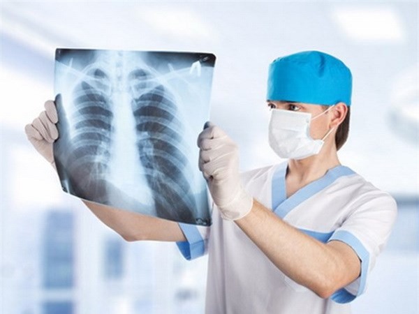 3 dấu hiệu của ung thư phổi: Chuyên gia nhắc dù chỉ 1 dấu hiệu nhỏ cũng không nên bỏ qua - Ảnh 4.