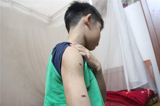 ha noi: be trai 9 tuoi bi diem kem, bo dung day dien bao hanh da man - 1
