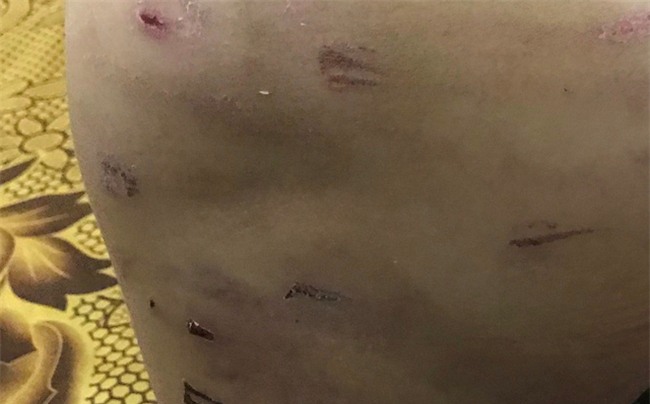 Bố đẻ bị tố đánh con dã man: Hôm đó tôi nóng giận quá nên mất khôn - Ảnh 1.