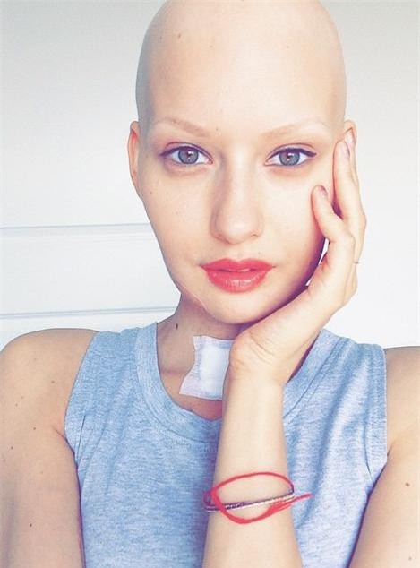 Mất 95% xương hàm và bị buộc phải bỏ đứa con trong bụng vì ung thư, cô người mẫu này đã làm một điều tuyệt vời - Ảnh 4.