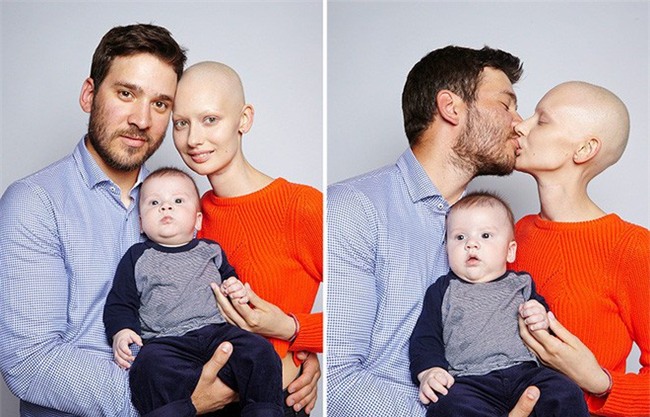 Mất 95% xương hàm và bị buộc phải bỏ đứa con trong bụng vì ung thư, cô người mẫu này đã làm một điều tuyệt vời - Ảnh 5.