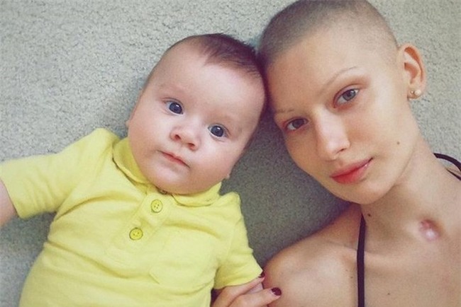 Mất 95% xương hàm và bị buộc phải bỏ đứa con trong bụng vì ung thư, cô người mẫu này đã làm một điều tuyệt vời - Ảnh 6.