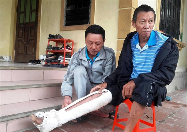 Loi khai cua nghich tu danh bo gay xuong suon hinh anh 2