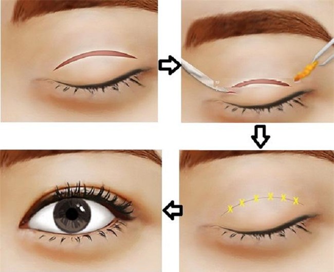 giua on ao 9x gap bien chung vi cat mi, chi em da biet gi ve loai hinh pttm nay? - 2