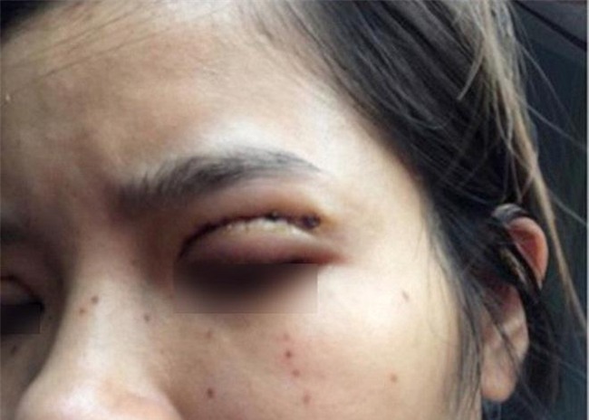 giua on ao 9x gap bien chung vi cat mi, chi em da biet gi ve loai hinh pttm nay? - 7