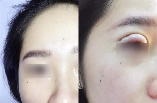 giua on ao 9x gap bien chung vi cat mi, chi em da biet gi ve loai hinh pttm nay? - 8