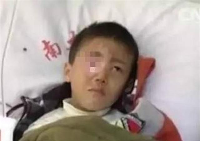 be trai 8 tuoi bi mu mat vinh vien vi nghich mon do quen thuoc nay - 1