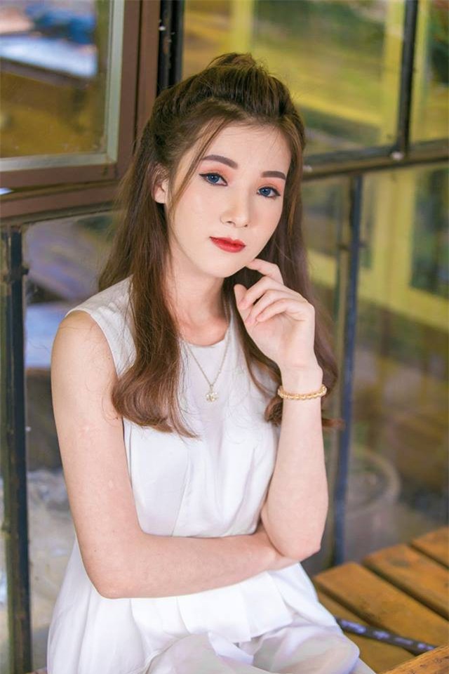 5 ca lột xác đổi đời thành công nhờ dao kéo gây xôn xao mạng xã hội năm 2017 - Ảnh 12.