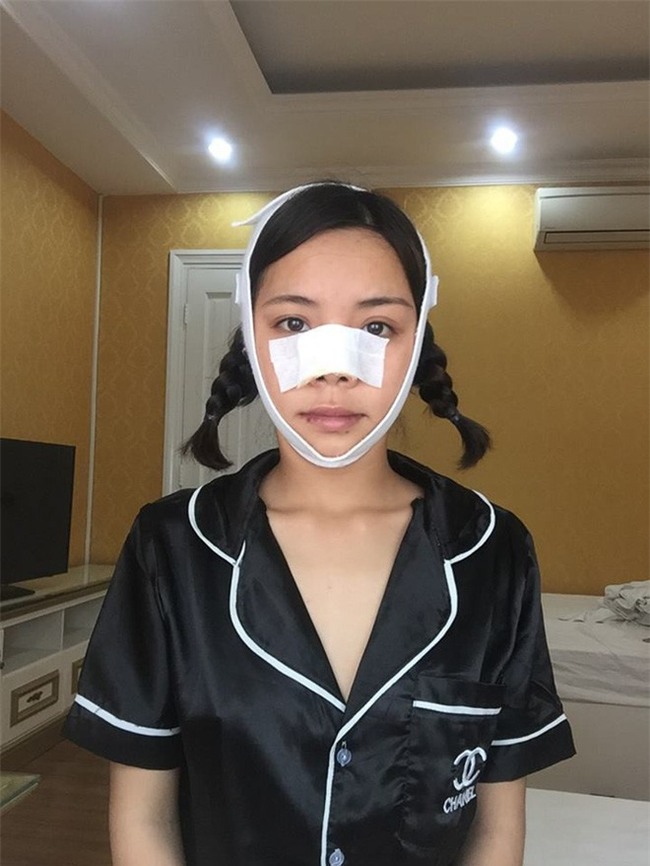 5 ca lột xác đổi đời thành công nhờ dao kéo gây xôn xao mạng xã hội năm 2017 - Ảnh 24.