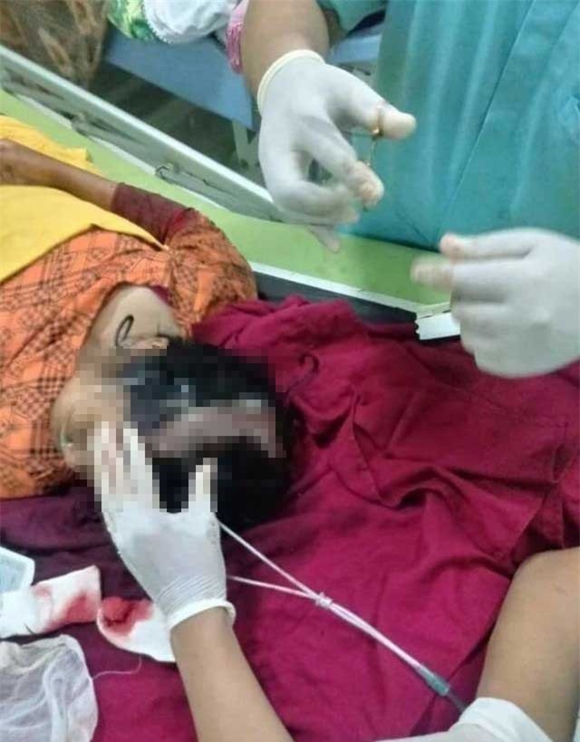 Hớn hở selfie bên đường ray, cô gái bị xe lửa đi qua va vào đầu phải nhập viện khẩn cấp - Ảnh 5.