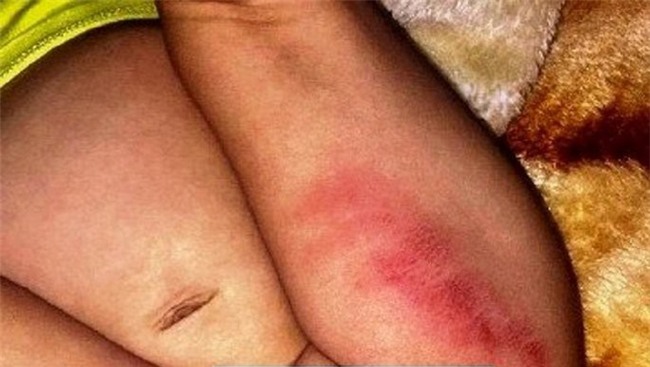 Sự thật bé gái 16 tháng tuổi nghi bị bạo hành tại điểm giữ trẻ tư nhân ở Huế - Ảnh 1.