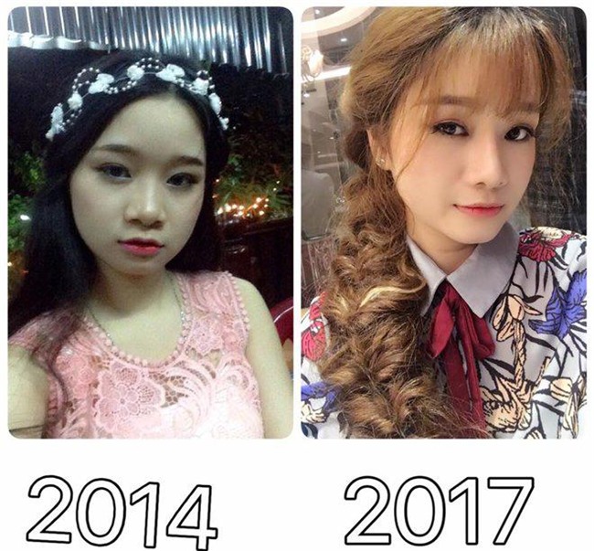 nhat ki cat mi mat cua co nang 9x tung lo so mat se bi "tron" sau phau thuat! - 1