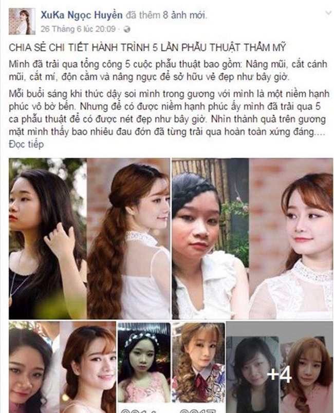 nhat ki cat mi mat cua co nang 9x tung lo so mat se bi "tron" sau phau thuat! - 2