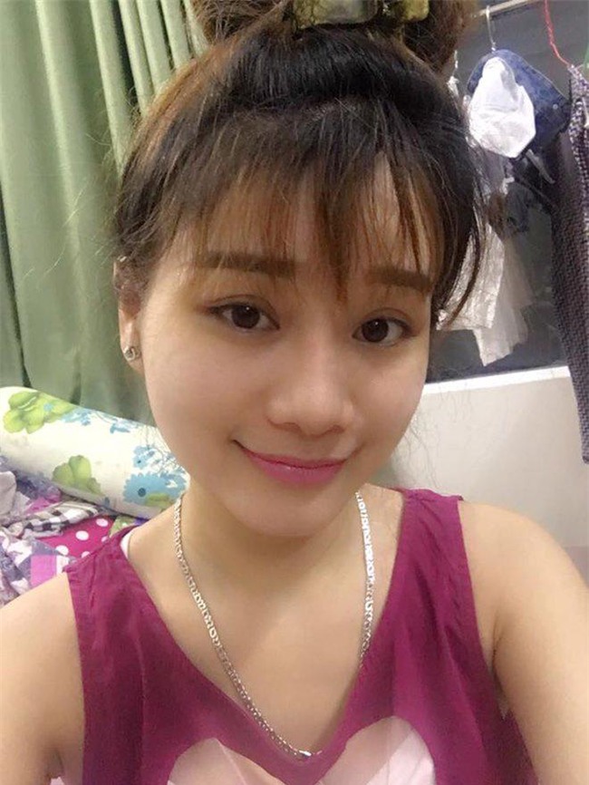 nhat ki cat mi mat cua co nang 9x tung lo so mat se bi "tron" sau phau thuat! - 6