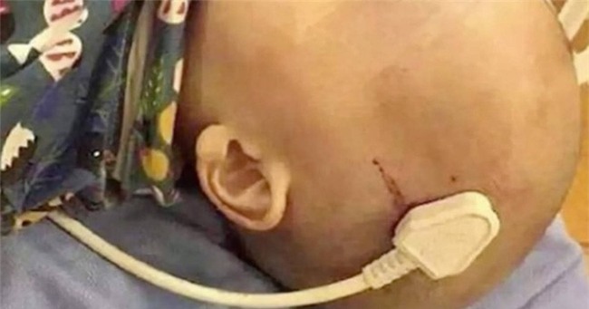 Bé trai bị đâm thủng sọ não vì sát thủ nhà nào cũng có mà bố mẹ chẳng bao giờ để ý tới - Ảnh 2.