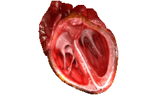 Căn bệnh đáng sợ, gây chết người nhanh hơn ung thư: Bạn có thuộc nhóm đối tượng dễ mắc?