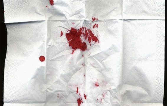 Nhận biết bệnh ung thư từ dấu hiệu bất thường của dạ dày và ruột: Bỏ qua sẽ gây nguy hiểm! - Ảnh 2.