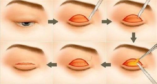 con sot cat mi o han va trung quoc da lan rong den viet nam nhu the nao? - 5