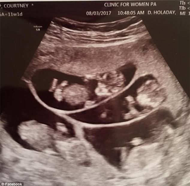 Chỉ sau 4 phút, cặp vợ chồng này đã trở thành bố mẹ của 9 đứa trẻ - Ảnh 2.