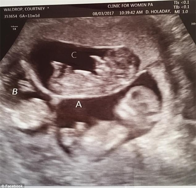 Chỉ sau 4 phút, cặp vợ chồng này đã trở thành bố mẹ của 9 đứa trẻ - Ảnh 3.