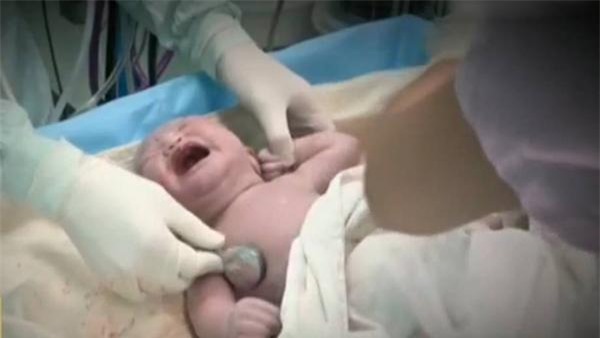 me bau di kham 39 tuan, bac si vua kiem tra tim thai lien hot hoang: "mo ngay!" - 4