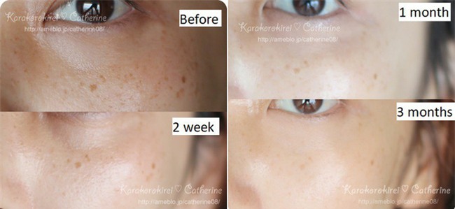 5 sản phẩm chăm sóc da bình dân được con gái Việt thi nhau tìm mua trong năm qua - Ảnh 14.