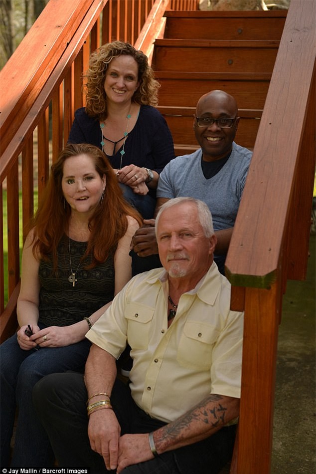 Dùng súng tự sát bất thành khiến dung mạo bị hủy hoại, người phụ nữ trải qua 49 cuộc phẫu thuật để làm lại cuộc đời - Ảnh 4.