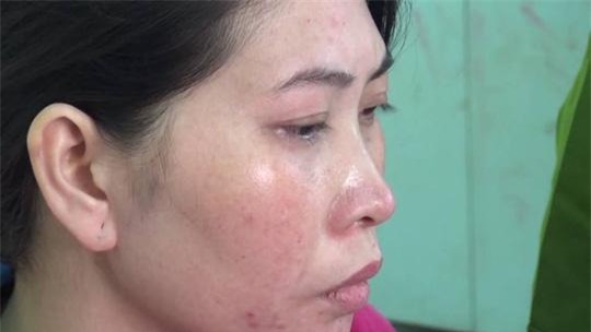 vu vo giet chong o binh duong: hang thi hong diem khong khoc nhung nhieu lan ngat xiu - 3