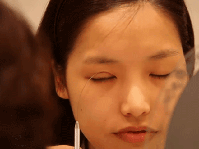 Làm đẹp - Cắt mí mắt hỏng: Do bác sĩ hãy do cách chăm sóc hậu phẫu thuật? Đâu là cách giải quyết?