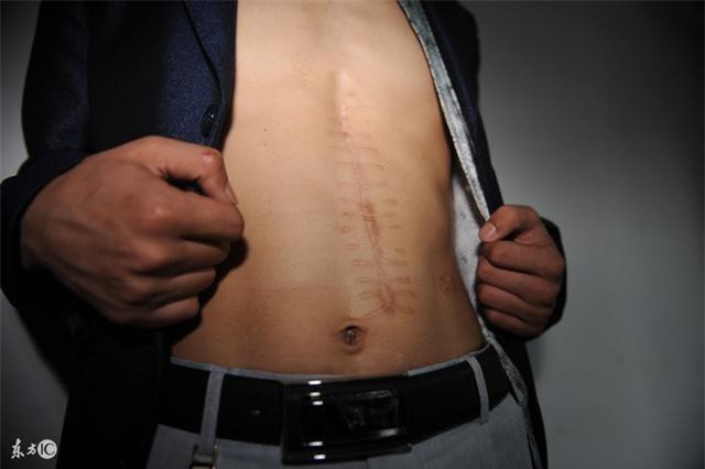 Bán thận vì không coi nó là gốc của sự sống, ai làm tốt 4 việc này thì thận mới bền - Ảnh 1.