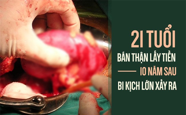 Bán thận vì không coi nó là gốc của sự sống, ai làm tốt 4 việc này thì thận mới 