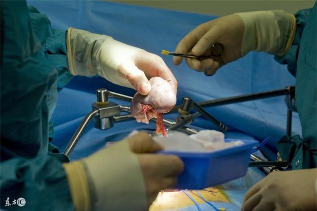 Bán thận vì không coi nó là gốc của sự sống, ai làm tốt 4 việc này thì thận mới bền - Ảnh 2.