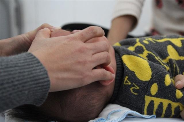 ha noi: ret dam duoi 9 do c, so nguoi nhap vien vi meo mom, tron mat gia tang - 2