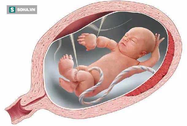 Con mới sinh tay chân đã có nhiều ngấn, bố toát mồ hôi khi bác sĩ nói để muộn phải cắt bỏ - Ảnh 2.