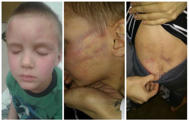 Nghịch ngợm mở quà Giáng sinh sớm, cậu bé 5 tuổi bị bạn trai của mẹ dùng dây nịt đánh dã man - Ảnh 3.