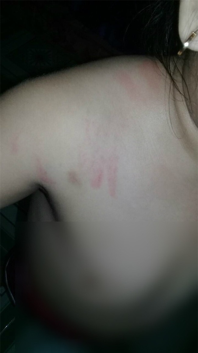 Bé gái 4 tuổi bị bạo hành ở Mầm Xanh tiếp tục có dấu hiệu bị đánh đập ở cơ sở giữ trẻ mới - Ảnh 3.