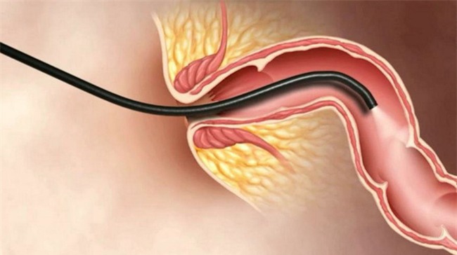 4 nhóm người buộc phải khám ung thư để tiêu diệt mầm bệnh ngay từ trong trứng nước - Ảnh 3.