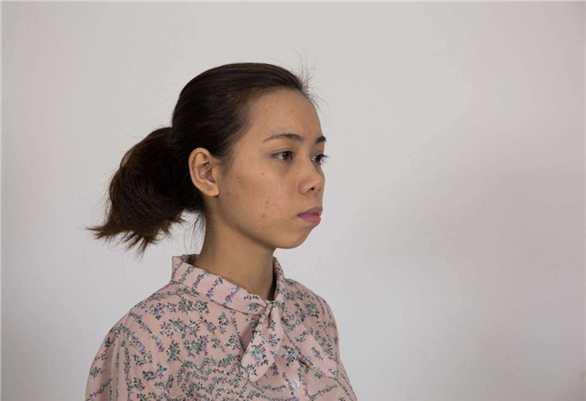 chi tien ti vao phau thuat tham my, va day la nhung man "hoa thien nga" gay chan dong 2017 - 10