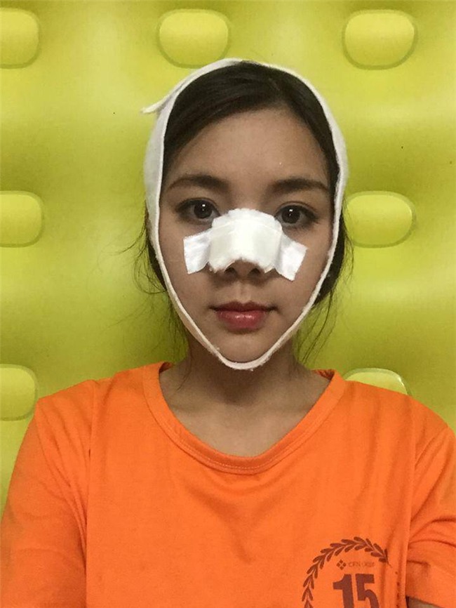 chi tien ti vao phau thuat tham my, va day la nhung man "hoa thien nga" gay chan dong 2017 - 11