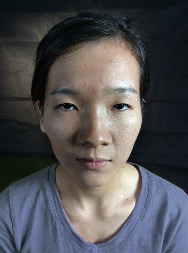 chi tien ti vao phau thuat tham my, va day la nhung man "hoa thien nga" gay chan dong 2017 - 9