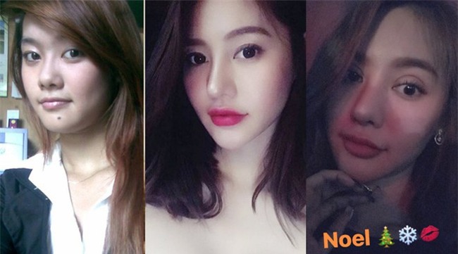 Mũi cao môi tều chưa đủ, Linh Chi quyết thay đổi nhan sắc hoàn toàn bằng đôi mắt 2 mí dày cộp - Ảnh 7.