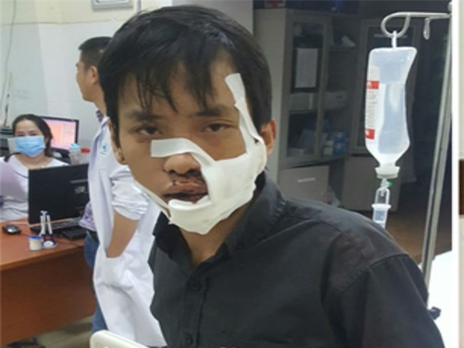 Chém nhau kinh hoàng trên phố, 5 người nhập viện