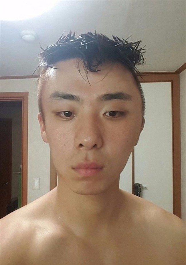 Chết cười với anh chàng Hàn Quốc bị dị ứng thuốc nhuộm tóc, đầu sưng to như quả bóng bay - Ảnh 6.