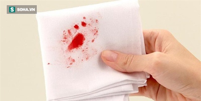 GĐ Trung tâm Ung bướu: Dấu hiệu sớm của ung thư đại trực tràng khi đi ngoài bạn cần chú ý-2