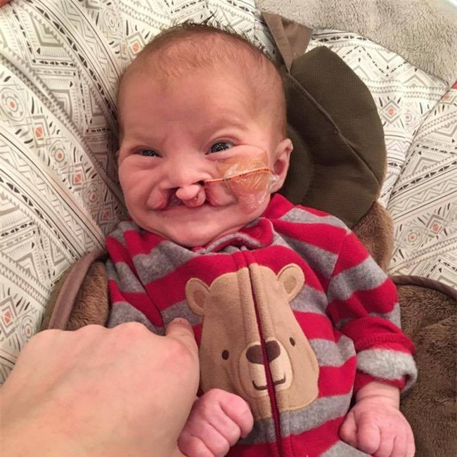 Con bị dị tật nhưng nhất quyết giữ đến cùng, nhiều tháng sau, người mẹ nhận được một thứ khiến cô rơi nước mắt - Ảnh 1.