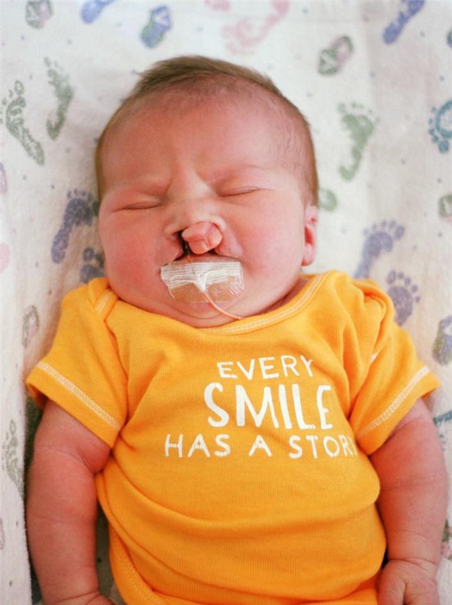 Con bị dị tật nhưng nhất quyết giữ đến cùng, nhiều tháng sau, người mẹ nhận được một thứ khiến cô rơi nước mắt - Ảnh 2.