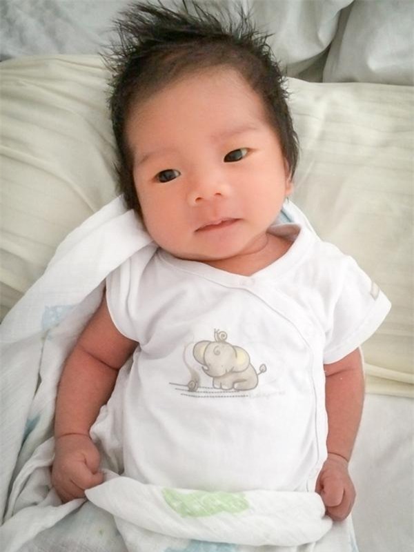 sau vu 3 tre so sinh xuat huyet nao, bac si chi cach phong tranh thieu hut vitamin k - 2